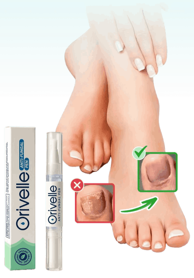 Oroville Nail Fungus Pen